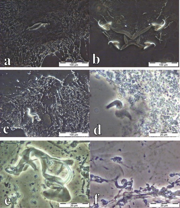 First record of monogenean fish parasites in the Upper Lufira River Basin  (Democratic Republic of Congo): dactylogyrids and gyrodactylids infesting  Oreochromis mweruensis, Coptodon rendalli and Serranochromis macrocephalus  (Teleostei: Cichlidae