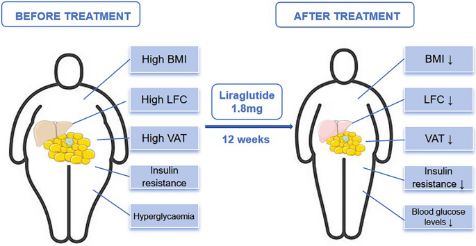 semaglutide visceral fat Semaglutide-Mediated Remodeling of Adipose Tissue in Type 2 Diabetes: Molecular Mechanisms Beyond Glycemic Control Does Semaglutide Target Visceral Fat