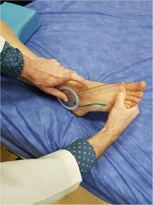 22. HOW TO USE A TENS UNIT WITH FOOT PAIN (TOP, HEEL, PLANTAR