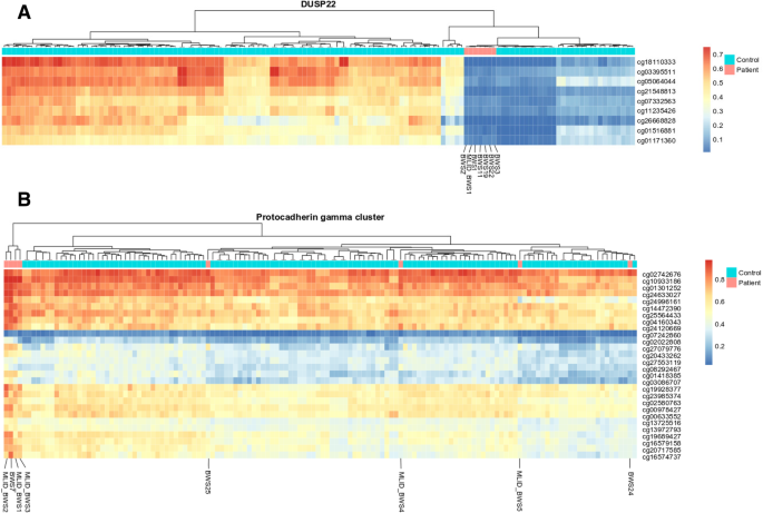 Beckwith-Wiedemann Syndrome - GeneReviews® - NCBI Bookshelf