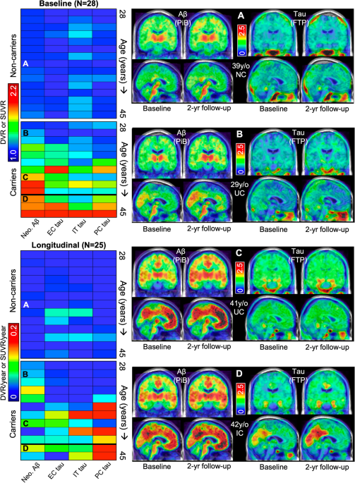 Longitudinal amyloid and tau accumulation in autosomal dominant Alzheimer's  disease: findings from the Colombia-Boston (COLBOS) biomarker study |  Alzheimer's Research & Therapy | Full Text