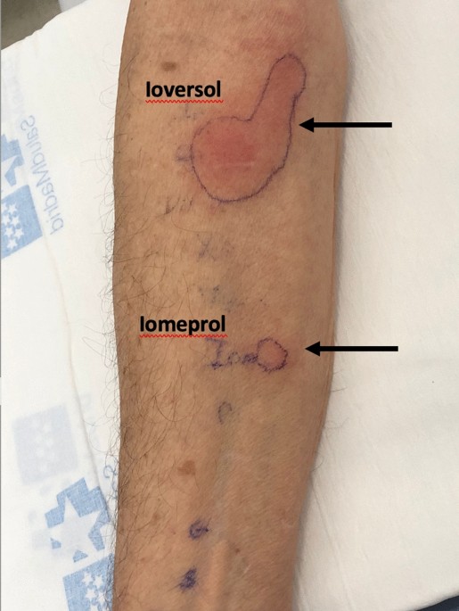 dress medical abbreviation Drug Reactions with Eosinophilia and Systemic Symptoms (DRESS): A Dermatologists Perspective Discover 62 Doctor Dress Code