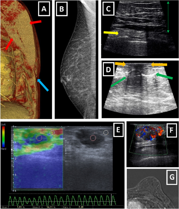Imaging findings and classification of the common and uncommon