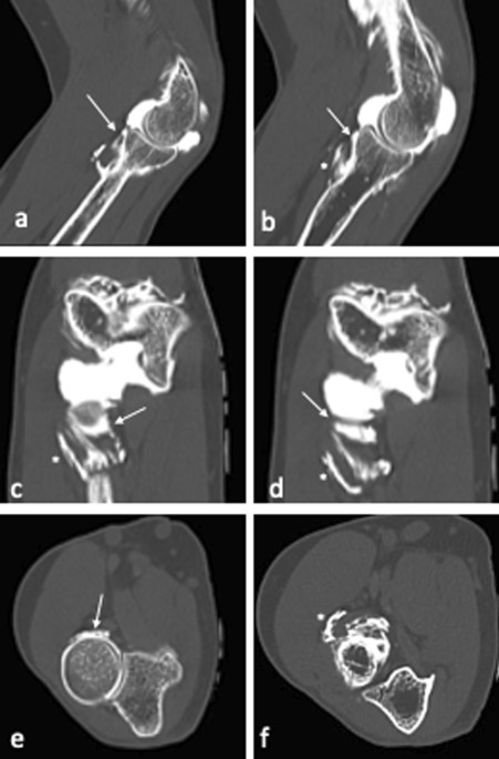 Contrast‐enhanced micro‐computed tomography of compartment and