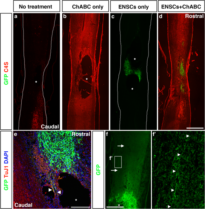 Combined treatment with enteric neural stem cells and chondroitinase ABC  reduces spinal cord lesion pathology | Stem Cell Research & Therapy | Full  Text
