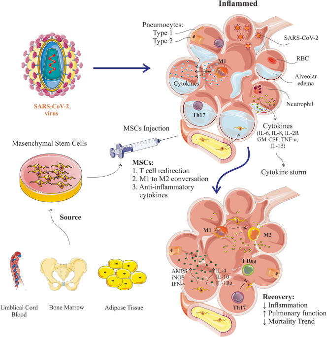 Mesenchymal stromal cells-based therapy in a murine model of