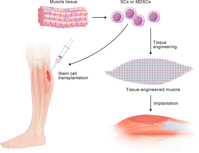 The role and therapeutic potential of stem cells in skeletal muscle in  sarcopenia, Stem Cell Research & Therapy