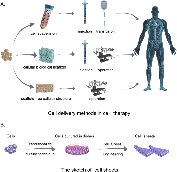The preclinical and clinical progress of cell sheet engineering in