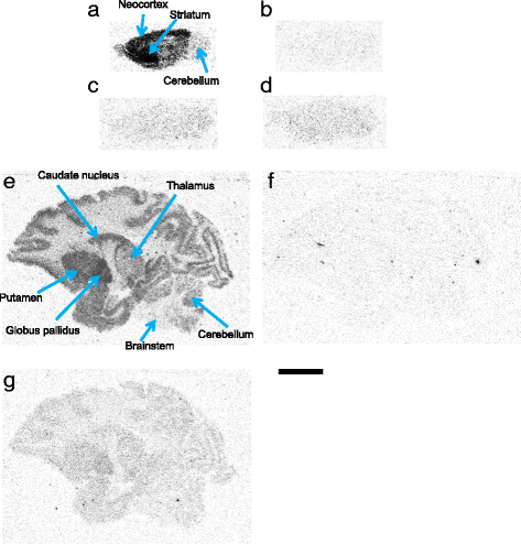 Development of Novel 11C-Labeled Selective Orexin-2 Receptor Radioligands  for Positron Emission Tomography Imaging