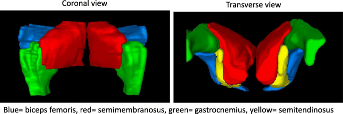 Frontiers  Fatal Ovarian Hemorrhage Associated With Anticoagulation  Therapy in a Yucatan Mini-Pig Following Venous Stent Implantation