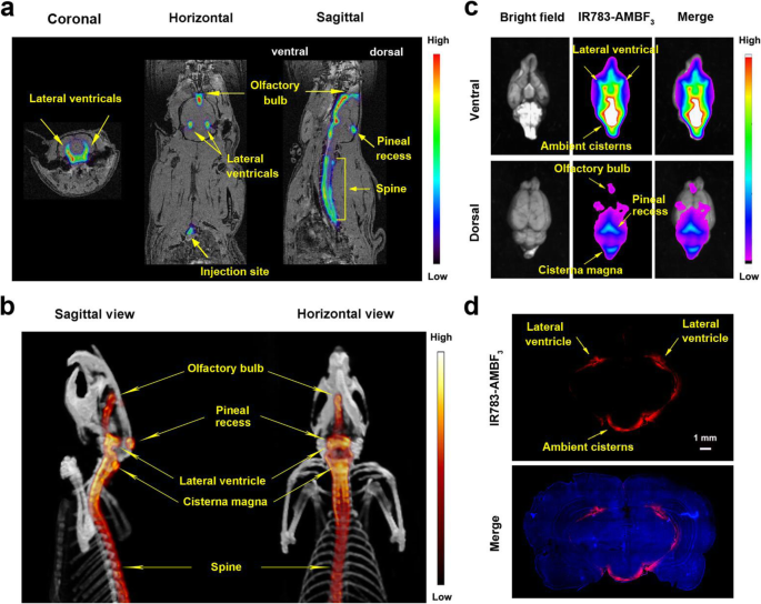 ICG near-infrared fluorescence angiography (using the LUNA system