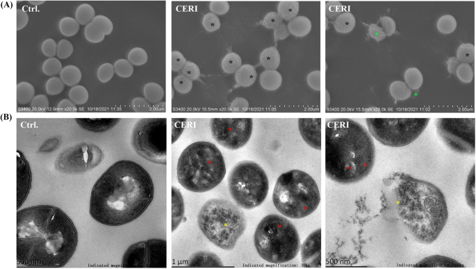 ESA - Staphylococcus aureus (MRSA) bacteria