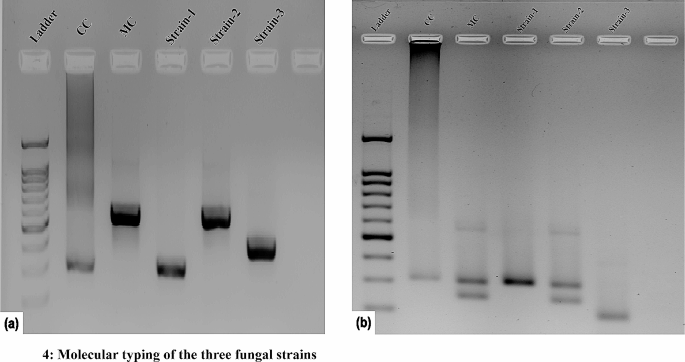 Fungal coexistence in the skin mycobiome: a study involving Malassezia,  Candida, and Rhodotorula, AMB Express