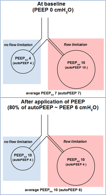 Effect of external PEEP in patients under controlled mechanical ventilation  with an auto-PEEP of 5 cmH2O or higher | Annals of Intensive Care | Full  Text