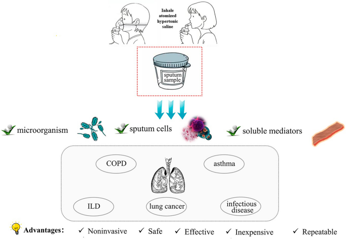 cough caused by glutathione Participation in the Prevention of Cardiovascular Diseases Frontiers | N-acetylcysteine: evidence based