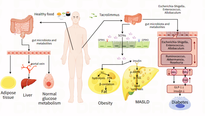 From bench to bed: deep insights the tacrolimus-induced diabetes and gut  microbiota dysbiosis | European Journal of Medical Research | Springer  Nature Link