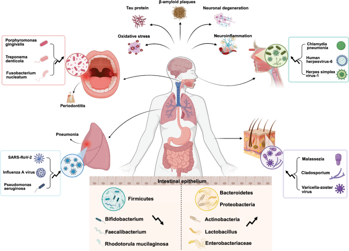 l carnitine cause constipation Microbiota and Alzheimer's disease: mechanistic insights from a multi-organ perspective | Translational Neurodegeneration