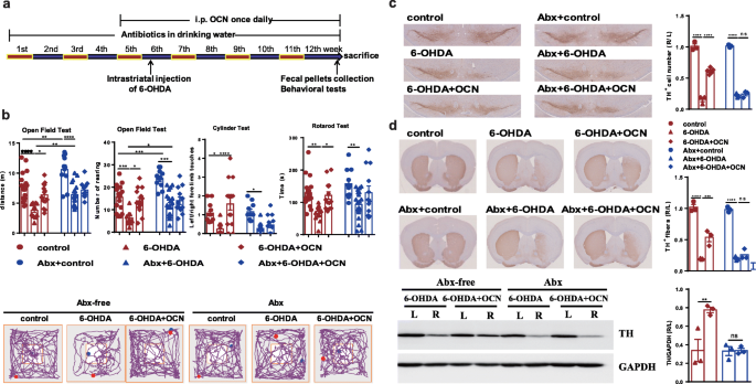 Fiber deprivation and microbiome-borne curli shift gut bacterial  populations and accelerate disease in a mouse model of Parkinson's disease  - ScienceDirect