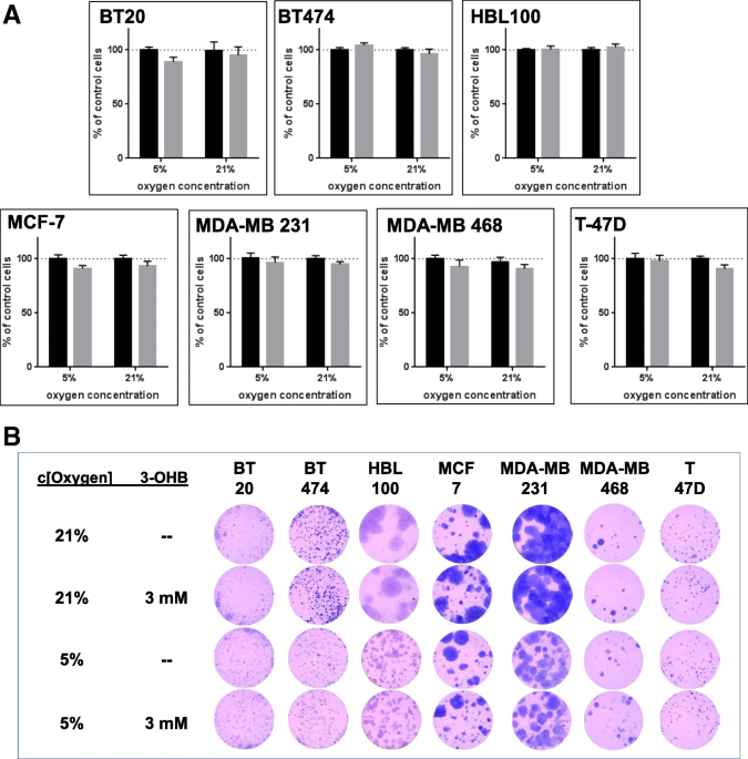 Beta-hydroxybutyrate (3-OHB) can influence the energetic phenotype of breast  cancer cells, but does not impact their proliferation and the response to  chemotherapy or radiation, Cancer & Metabolism