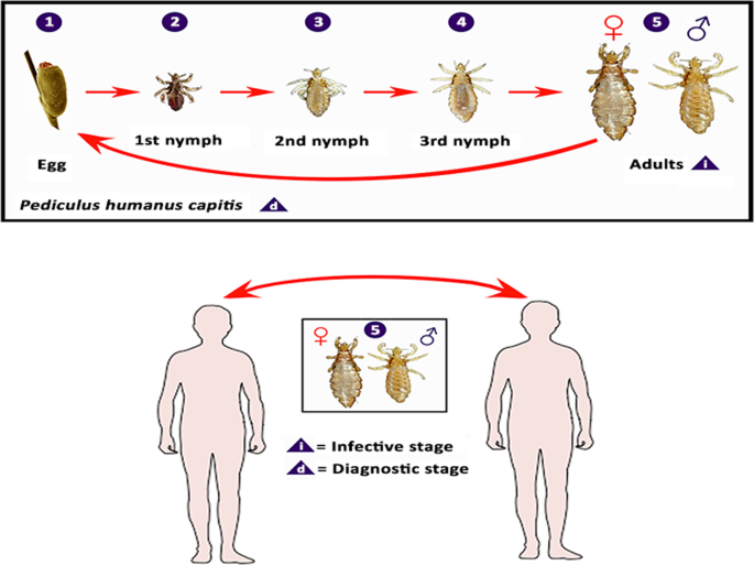 Human pediculosis, a global public health problem | Infectious Diseases of  Poverty | Full Text