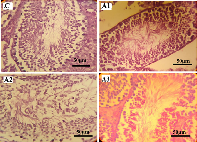 can you overdose on l glutathione Toxicological evaluation of paracetamol and ibuprofen: genetic and  hematological alterations in male albino mice | BMC Pharmacology and  Toxicology