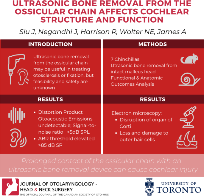 Otosclerosis, Otolaryngology⁠ — Head & Neck Surgery