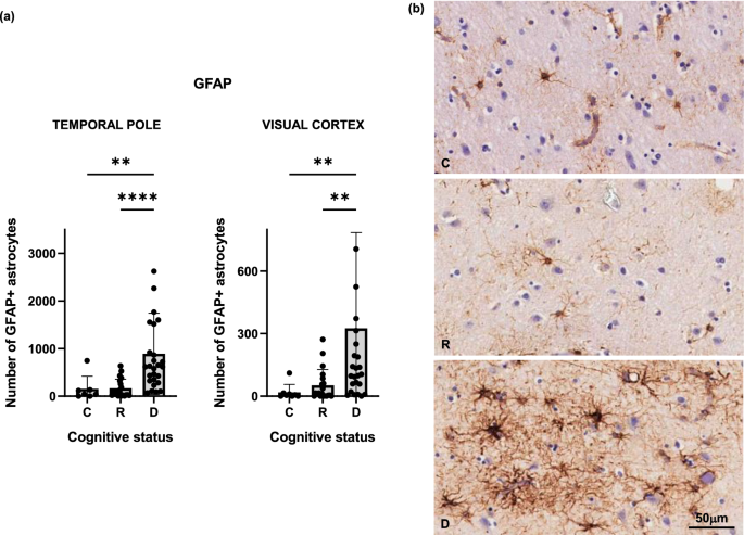 Changes in glial cell phenotypes precede overt neurofibrillary