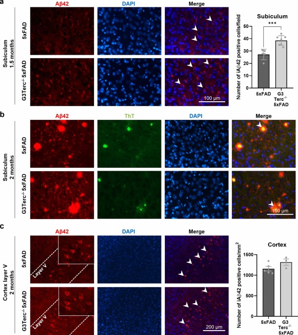 Senescence-related impairment of autophagy induces toxic intraneuronal  amyloid-β accumulation in a mouse model of amyloid pathology | Acta  Neuropathologica Communications | Full Text