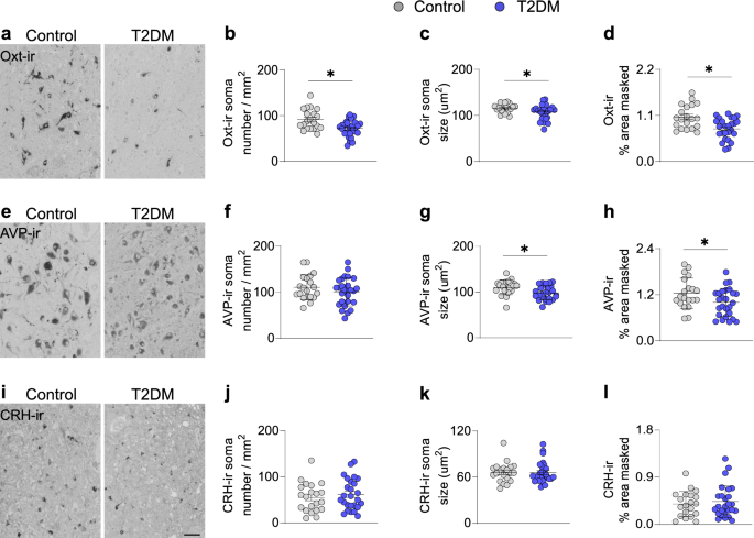 Neuroanatomical organization and functional roles of PVN MC4R pathways in  physiological and behavioral regulations