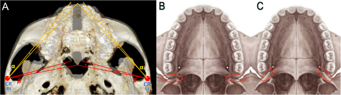 How Mewing Works - The Maxilla Sutures – Spartan Health™