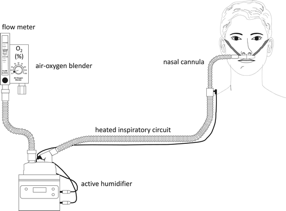 High-flow nasal cannula oxygen therapy in adults | Journal of Intensive  Care | Full Text