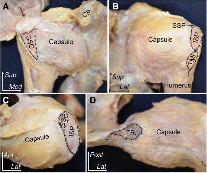 Anatomic analysis of the whole articular capsule of the shoulder joint,  with reference to the capsular attachment and thickness | Journal of  Experimental Orthopaedics | Full Text