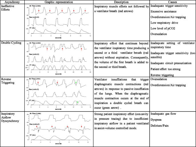Patient-ventilator asynchronies during mechanical ventilation: current  knowledge and research priorities | Intensive Care Medicine Experimental |  Full Text