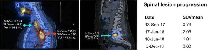 Markers for every imaging modality & disease site » medisynt