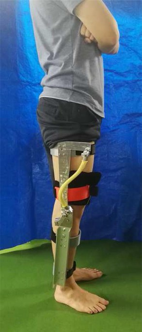 Design of knee support device based on four-bar linkage and hydraulic  artificial muscle | ROBOMECH Journal | Full Text