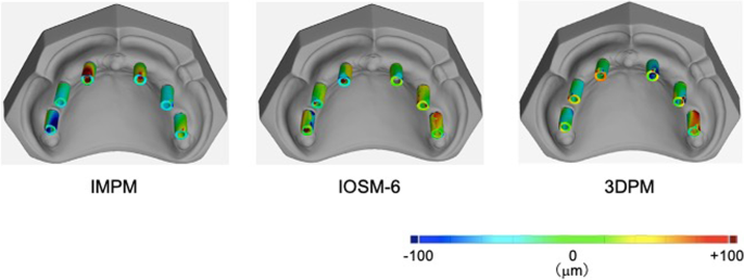 Can you use an intraoral scanner for upper jaw impressions