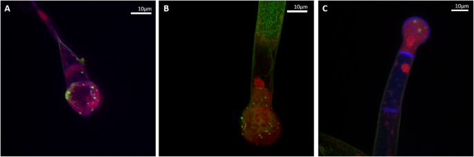 Glandular trichomes of Asteraceae species in light microscopy (b-h, j