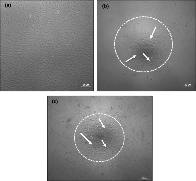 PDF) Development of hydroxiapatite porous bioceramics for use as