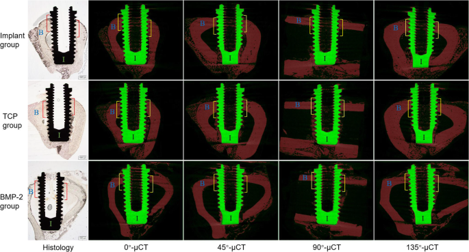 Micro-ct values of OWA (in mm2) (A) and CUR (B) among hominoid living