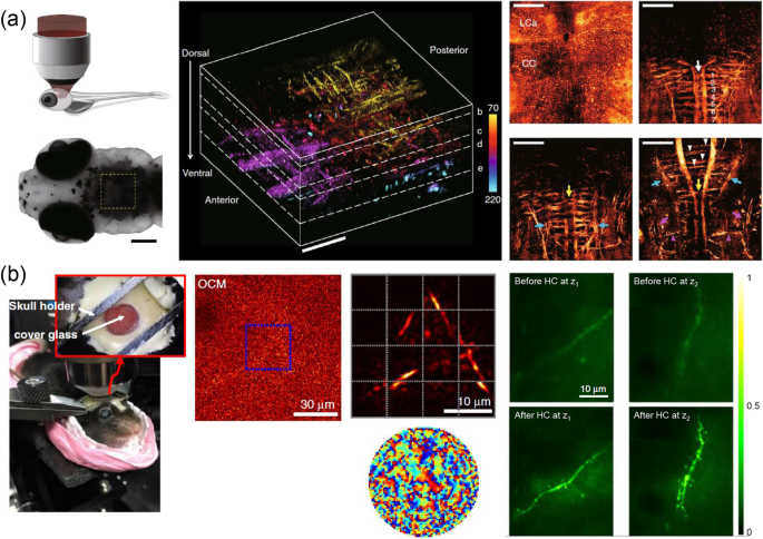 Recent advances in optical imaging through deep tissue: imaging probes and  techniques | Biomaterials Research | Full Text