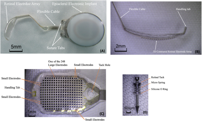 First human implantation of the WFMA for intracortical visual