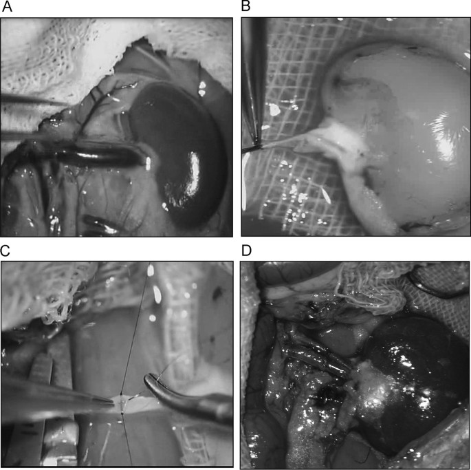 can i take glutathione with atorvastatin High-dose atorvastatin reduces oxidative stress of ischemia/reperfusion  injury after isogeneic kidney transplantation in rats: in vivo,  preclinical, case–control, open-label study | Renal Replacement Therapy