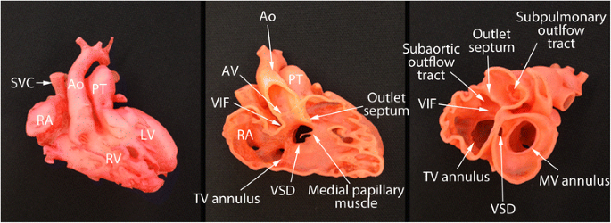 Illustration of the interpolated 3D heart model and triangle