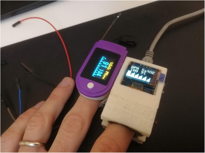 3D printing technology and internet of things prototyping in family  practice: building pulse oximeters during COVID-19 pandemic | 3D Printing  in Medicine | Full Text