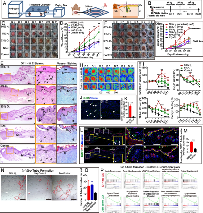 Molecular hydrogen promotes wound healing by inducing early epidermal stem  cell proliferation and extracellular matrix deposition | Inflammation and  Regeneration | Springer Nature Link