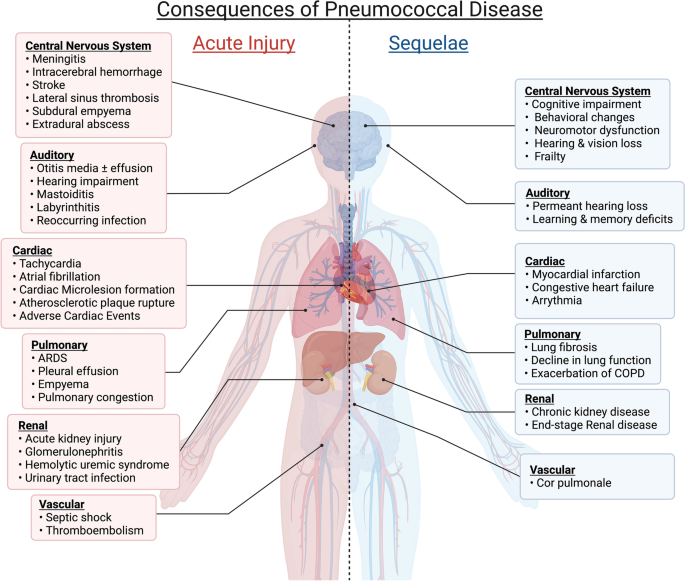 Acute organ injury and long-term sequelae of severe pneumococcal infections  | Pneumonia | Full Text