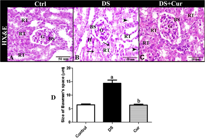 Protective effect of curcumin on the kidney of diclofenac sodium-challenged  mice: apoptotic, redox potential and histopathological outcomes | The  Journal of Basic and Applied Zoology | Full Text