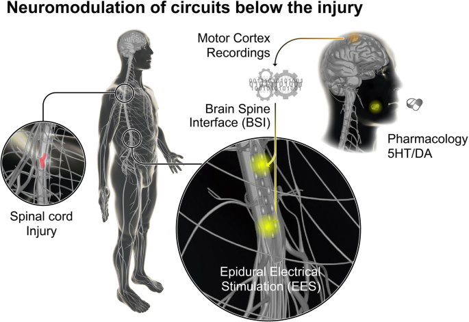 Wireless, Fully Implantable and Expandable Electronic System for  Bidirectional Electrical Neuromodulation of the Urinary Bladder