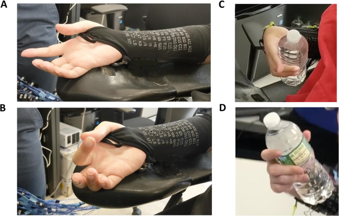 Robotic and neuromuscular electrical stimulation (NMES) hybrid system -  ScienceDirect