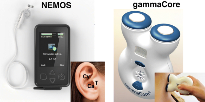 gammaCore®, the First Non-Invasive Vagus Nerve Stimulator Applied